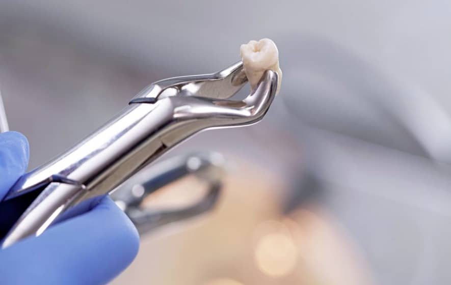 tooth